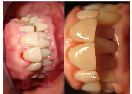 Periodontics